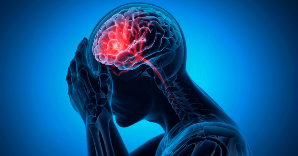 Man with a headache - Brain Stroke - 3D Illustration
